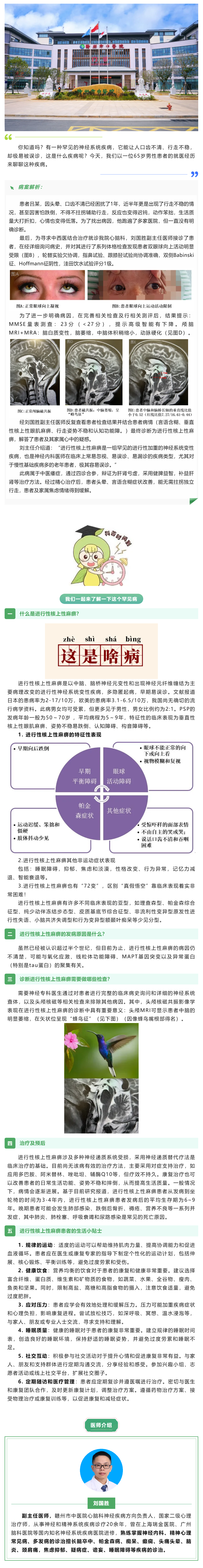 口齒不清、行走不穩(wěn)？警惕這種神經(jīng)系統(tǒng)罕見病——進行性核上性麻痹.png