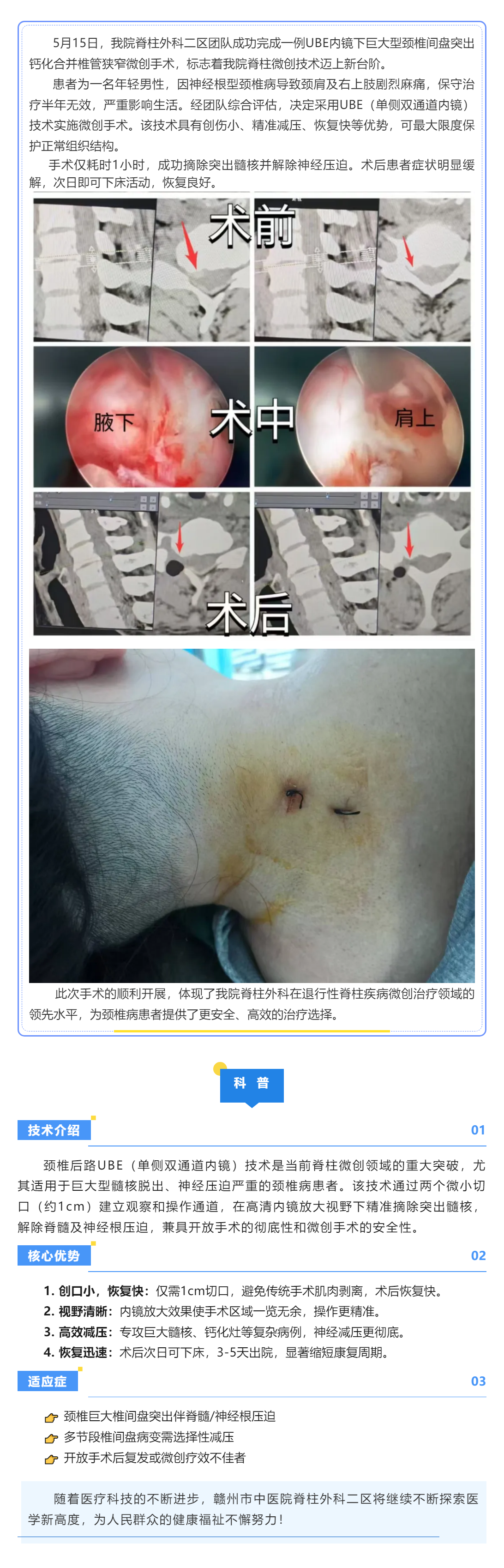 當(dāng)天手術(shù)&rarr;次日下床：UBE技術(shù)讓頸椎病康復(fù)快3倍！.png