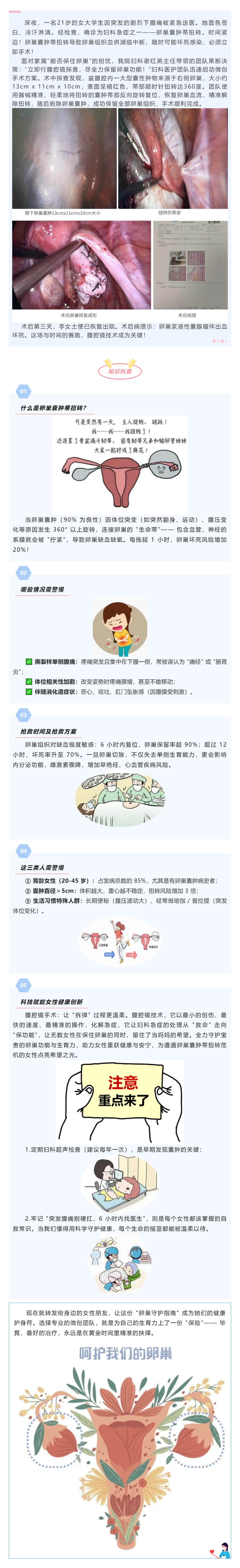 【科普】卵巢囊腫蒂扭轉(zhuǎn)&mdash;&mdash;不可忽視的&ldquo;婦科急腹癥&rdquo;.png